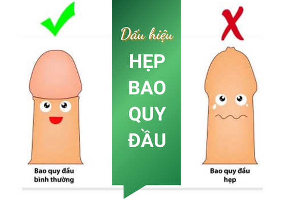 05 nguyên nhân hẹp bao quy đầu ở nam