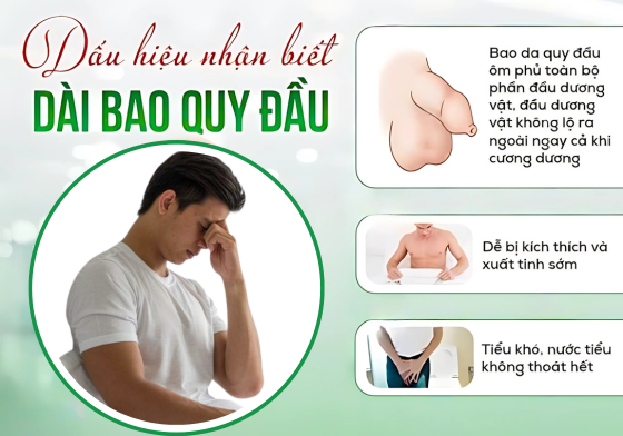 Cách Điều Trị Dài Bao Quy Đầu An Toàn Hiệu Quả Hiện Nay