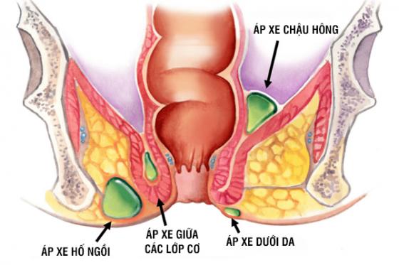 ap-xe-hau-mon-3.jpg