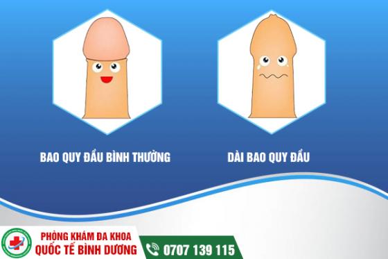 dai-bao-quy-dau-4.jpg